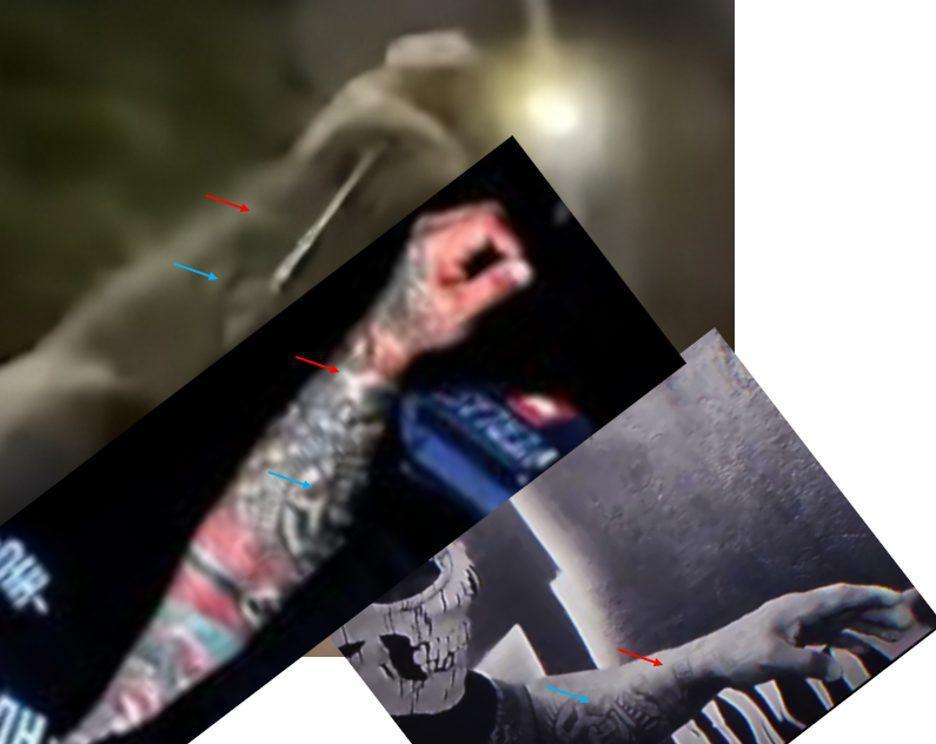 Comparación de marcas y tatuajes del brazo