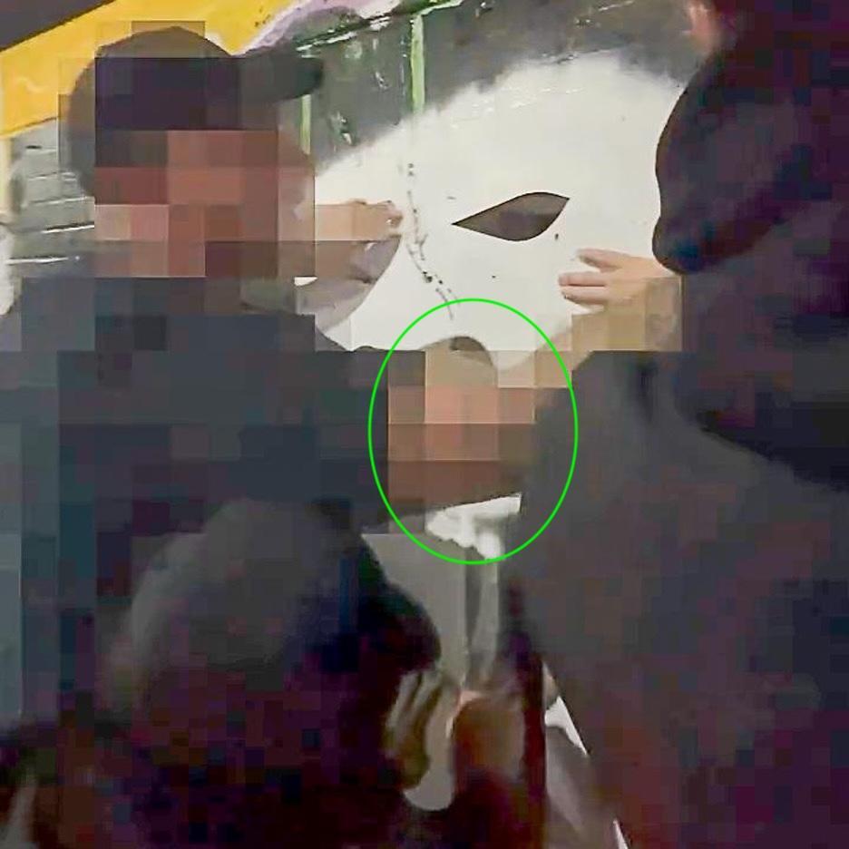 Detalle del brazo de una persona pixelada